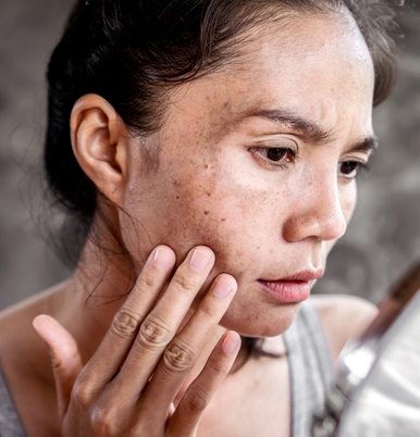 Pigmentation Solutions Image